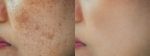 woman dark spots